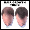 Picture of Regrowth Hair Tonic & Shampoo Treatment Pack