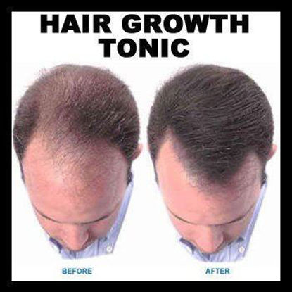 Picture of Regrowth Hair Tonic & Shampoo Treatment Pack